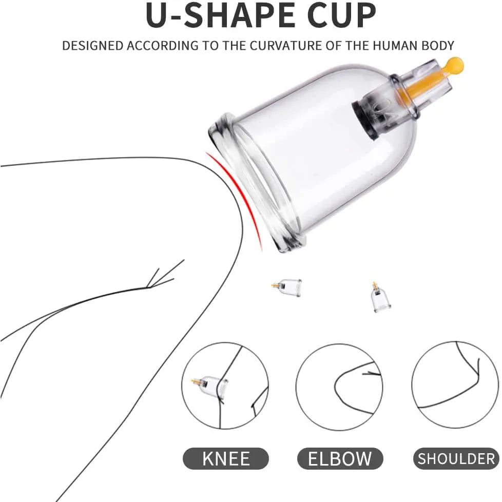 Professional Acupoint Cupping Set, 4th Generation Pump Gun & Cups (12 Cups) - Buy at New Green Nutrition
